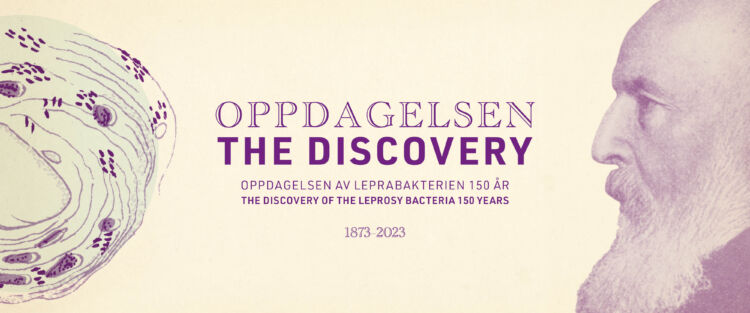 Oppdagelsen av leprabakterien 150 år
